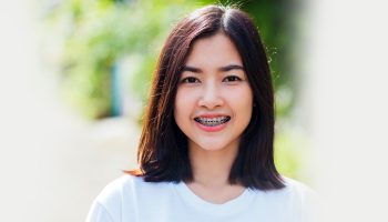 How To Correct Misaligned Teeth With Orthodontic Treatments.