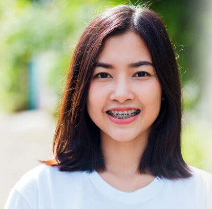 How To Correct Misaligned Teeth With Orthodontic Treatments.