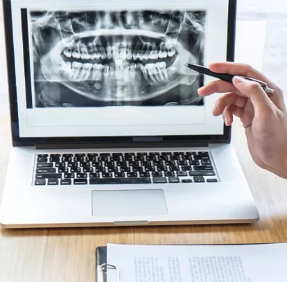 Advantages Of Digital Panoramic X-Rays Over Traditional X Rays