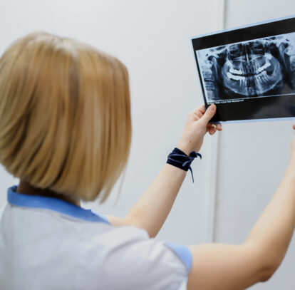 Exploring the Benefits of Ceph-X-rays