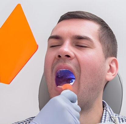 How Wisdom Teeth Lead to Crowding and Impaction