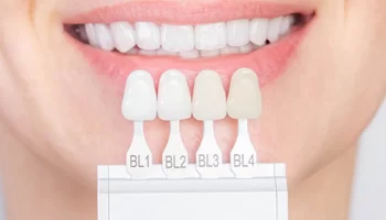 Say Goodbye to Dental Imperfections with Composite Veneers