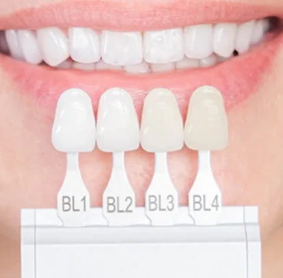 Say Goodbye to Dental Imperfections with Composite Veneers
