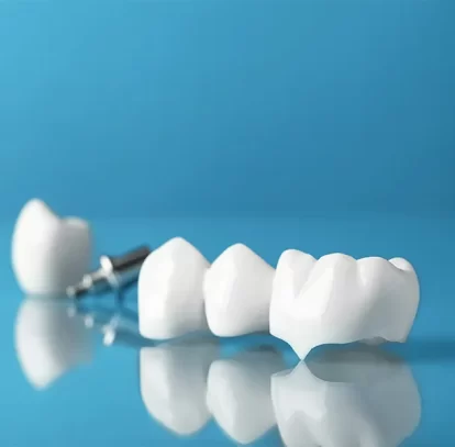 Why is choosing a Trusted Dentist for Your Dental Crown in Hamilton important?